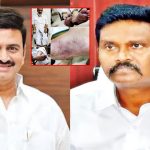 Raghurama Torture Case: తెలియదు.. గుర్తులేదు.. రఘురామరాజు కేసులో నోరువిప్పని A1 సునీల్