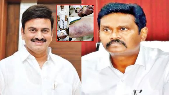 Raghurama Torture Case: తెలియదు.. గుర్తులేదు.. రఘురామరాజు కేసులో నోరువిప్పని A1 సునీల్
