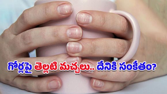 White Spots On Nails: చేతివేళ్ల గోర్లపై తెల్లటి మచ్చలు ఏర్పడ్డయా?.. ఈ రోగాలకు సంకేతం కావొచ్చంటున్న వైద్యులు!