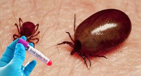 Scrub Typhus: రాష్ట్రంలో స్క్రబ్ టైఫస్ కలకలం.. పెరుగుతున్న మరణాల సంఖ్య!
