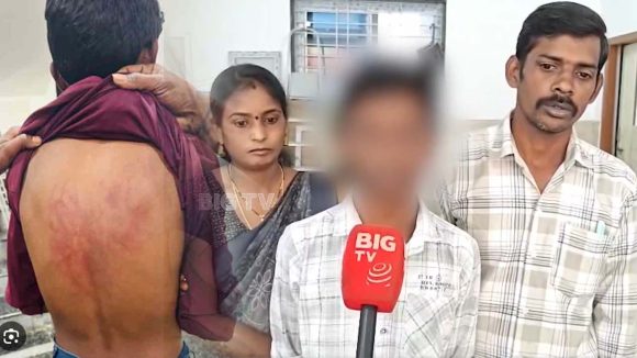 Kompalli: దారుణం.. గురువే కిరాతకుడై.. విద్యార్థిపై తోటివారితో దాడి చేయించిన హెడ్ మాస్టర్