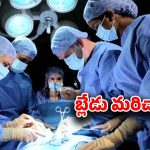 Palnadu District: వైద్యుడి నిర్వాకం.. ఆపరేషన్ చేసి.. కడుపులో బ్లేడు వదిలేశాడు..
