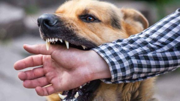 Dog Bite New Rules: పెంపుడు కుక్కలున్నాయా? పొరపాటున కరిస్తే ఓనర్‌పై ఎఫ్ఐఆర్, ఇదెక్కడి రూల్ బాబోయ్