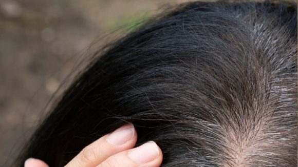 White Hair: ఒక్క తెల్లవెంట్రుక పీకితే అక్కడ పది పుట్టుకొస్తాయా?