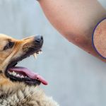Dog Bite: కుక్క కరిచిన వెంటనే.. ఏం చేయాలో తెలుసా ?