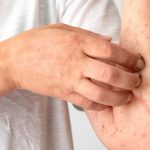 Fatty Liver Signs: మీ కాలేయం ఆరోగ్యంగా ఉందో లేదో మీ చేతులే చెప్తాయ్.. ఈ 5 లక్షణాలు చెక్ చేసుకోండి