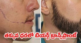 Swiggy Report: హైదరాబాదీలకు ఇష్టమైన ఫుడ్స్ ఇవే.. టాప్‌లో బిర్యానీ, తర్వాతి ప్లేసులో ఆ ఫుడ్!