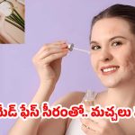 Homemade Night Serum: మచ్చలను తొలగించే హోం మేడ్ సీరం.. సింపుల్‌గా తయారు చేసుకోండిలా !