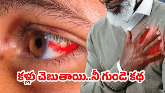 Eye Signs: హార్ట్ ఎటాక్ ముప్పును ముందే పసిగట్టే కళ్లు!
