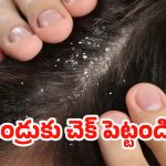 Dandruff Home Remedies: చలికాలంలో చుండ్రు వల్ల జుట్టు రాలుతోందా? ఈ చిట్కాలు పాటిస్తే రిజల్ట్ పక్కా!