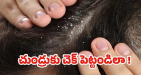 Dandruff Home Remedies: చలికాలంలో చుండ్రు వల్ల జుట్టు రాలుతోందా? ఈ చిట్కాలు పాటిస్తే రిజల్ట్ పక్కా!