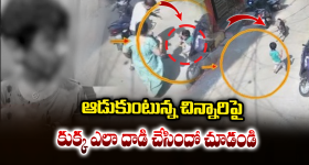 Khairatabad Dog Attack: వీధి కుక్కల వేట.. చిన్నారి ముఖంపై తీవ్ర గాయాలు..  ఖైరతాబాద్‌లో కలకలం