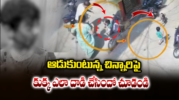 Khairatabad Dog Attack: వీధి కుక్కల వేట.. చిన్నారి ముఖంపై తీవ్ర గాయాలు..  ఖైరతాబాద్‌లో కలకలం