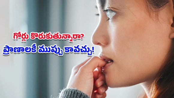 Nail Biting Side Effects: సైలెంట్ ఎనిమీ.. గోర్లు కొరకడం వల్ల శరీరంలోకి చేరే వేలకోట్ల బ్యాక్టీరియా గురించి మీకు తెలుసా?