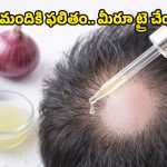 Onion Juice for Hair Regrowth: బట్టతలపై జుట్టు మొలిపించే ఉల్లిపాయ రసం.. ఇంతకీ సైన్స్ ఏం చెబుతోందంటే?