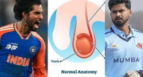 Tilak Varma Surgery: తిల‌క్ వ‌ర్మ‌కు జ‌రిగిన స‌ర్జ‌రీ ఏంటి? అంత ప్ర‌మాద‌క‌ర‌మా, శ్రేయాస్ అయ్య‌ర్ కు పిలుపు !