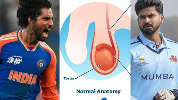 Tilak Varma Surgery: తిల‌క్ వ‌ర్మ‌కు జ‌రిగిన స‌ర్జ‌రీ ఏంటి? అంత ప్ర‌మాద‌క‌ర‌మా, శ్రేయాస్ అయ్య‌ర్ కు పిలుపు !
