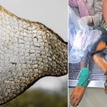 Hyderabad News: చేప చర్మంతో కుక్కకు సర్జరీ.. పశువైద్యంలో మైలురాయి, హైదరాబాద్‌ డాక్టర్ల ఘనత