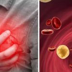 High cholesterol: హై కొలెస్ట్రాల్ లక్షణాలు ఇవే.. లైట్ తీసుకుంటే చాలా డేంజర్ !