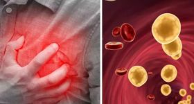 Knee Pain: ఎన్ని మందులు వాడినా మోకాళ్ల నొప్పులు తగ్గట్లేదా? ఈ హోం రెమెడీస్ ట్రై చేయండి
