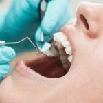 Life Expectancy Dental Study: మీరు ఎంతకాలం జీవిస్తారో తెలుసుకోవచ్చు.. దంతాలలో దాగి ఉన్న రహస్యం