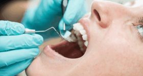 Life Expectancy Dental Study: మీరు ఎంతకాలం జీవిస్తారో తెలుసుకోవచ్చు.. దంతాలలో దాగి ఉన్న రహస్యం