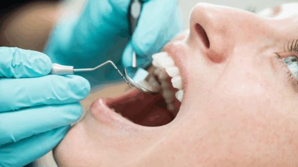 Life Expectancy Dental Study: మీరు ఎంతకాలం జీవిస్తారో తెలుసుకోవచ్చు.. దంతాలలో దాగి ఉన్న రహస్యం