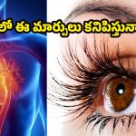 Heart Disease: కంటి పరీక్షలతోనే హార్ట్ ఎటాక్ ముప్పును పసిగట్టవచ్చు! అదెలాగంటే ?