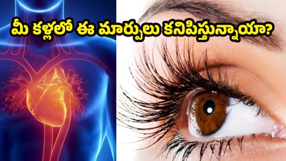 Heart Disease: కంటి పరీక్షలతోనే హార్ట్ ఎటాక్ ముప్పును పసిగట్టవచ్చు! అదెలాగంటే ?