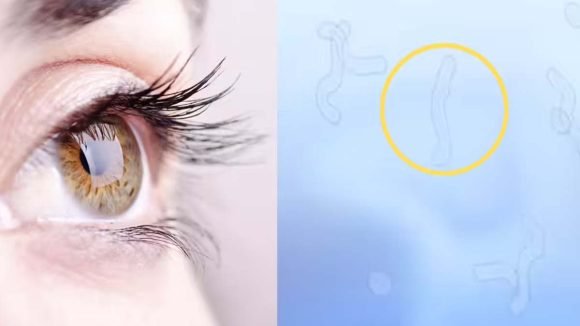 Eye care: కళ్ల ముందు నల్లటి చుక్కలు కనిపిస్తున్నాయా? డాక్టర్లు చెబుతున్న షాకింగ్ నిజాలివే!