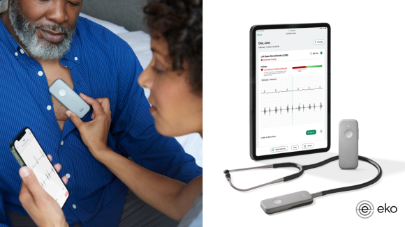 AI Stethoscopes: ఏఐ స్టెతస్కోప్‌తో గుండె జబ్బులను ముందే పసిగట్టవచ్చు తెలుసా ?