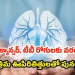 Artificial Lung System: వైద్య రంగంలో అద్భుతం.. ఊపిరితిత్తులు లేకుండానే రెండు రోజుల పాటు ప్రాణాలతో!