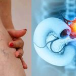 Pancreatic Cancer: మిలియన్ల మందిని బలితీసుకుంటున్న వ్యాధి.. కాళ్లలో కనిపించే ఈ లక్షణాలే మొదటి వార్నింగ్!