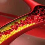 Blocked arteries: బ్లాక్ అయిన రక్తనాళాలను క్లియర్ చేసే 3 సహజ అలవాట్లు ఇవే.