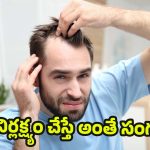 Hair Fall: బట్టతల రాకూడదా? ఇలా జరిగితే అప్రమత్తం అవ్వండి