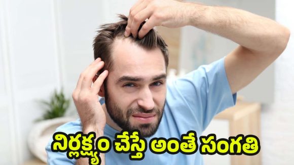 Hair Fall: బట్టతల రాకూడదా? ఇలా జరిగితే అప్రమత్తం అవ్వండి