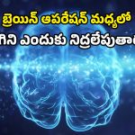 Awake Brain Mapping: బ్రెయిన్ సర్జరీలో మాట పడిపోకుండా కొత్త టెక్నిక్.. ఇక భయం లేనట్టే!