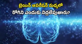 Awake Brain Mapping: బ్రెయిన్ సర్జరీలో మాట పడిపోకుండా కొత్త టెక్నిక్.. ఇక భయం లేనట్టే!