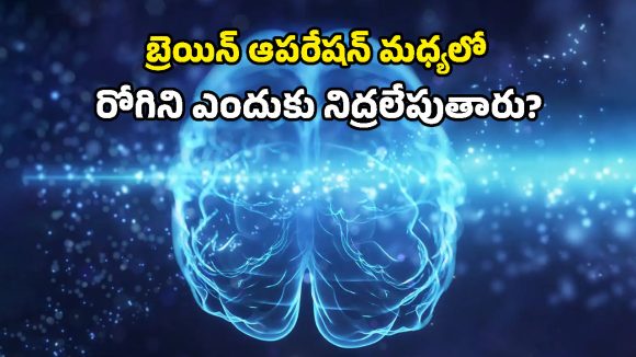 Awake Brain Mapping: బ్రెయిన్ సర్జరీలో మాట పడిపోకుండా కొత్త టెక్నిక్.. ఇక భయం లేనట్టే!