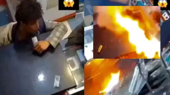 Battery Explosion: రీల్స్ పిచ్చా? అమాయకత్వమా? నోట్లో బ్యాటరీ పేలి బాలుడి పరిస్థితి..!