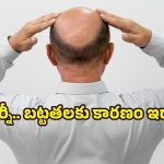 Hair loss in men: పురుషుల్లోనే ఎక్కువగా జుట్టు రాలడానికి గల 4 ప్రధాన కారణాలు ఇవే!