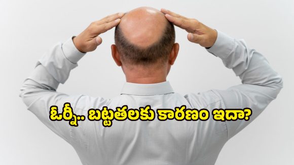 Hair loss in men: పురుషుల్లోనే ఎక్కువగా జుట్టు రాలడానికి గల 4 ప్రధాన కారణాలు ఇవే!