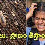 Head Lice Infestation: తలలో పేలు.. మనుషులను చంపేస్తాయా? ఆ బాలిక మరణానికి కారణం పేలేనా?