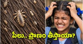 Head Lice Infestation: తలలో పేలు.. మనుషులను చంపేస్తాయా? ఆ బాలిక మరణానికి కారణం పేలేనా?