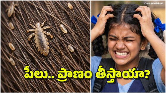 Head Lice Infestation: తలలో పేలు.. మనుషులను చంపేస్తాయా? ఆ బాలిక మరణానికి కారణం పేలేనా?