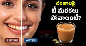 Stains On Teeth: టీ, కాఫీల వల్ల దంతాలు రంగు మారుతున్నాయా? ఇలా చేస్తే మిలమిలా మెరుస్తాయ్!
