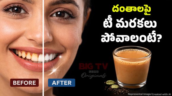 Stains On Teeth: టీ, కాఫీల వల్ల దంతాలు రంగు మారుతున్నాయా? ఇలా చేస్తే మిలమిలా మెరుస్తాయ్!