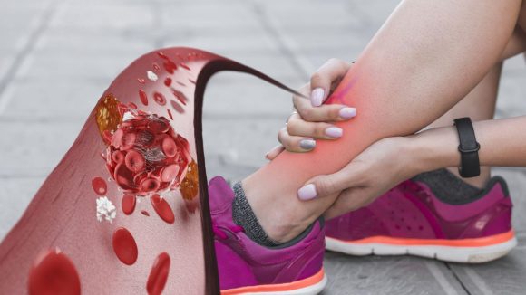 Poor Blood Circulation: చల్లని చేతులు, పాదాలు.. ఇది రక్త ప్రసరణ సమస్యకు సంకేతమా ?