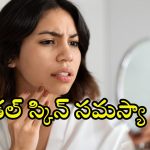 Vitamins For Skin: చర్మం కాంతి కోల్పోయిందా ? ఈ 5 విటమిన్లు మీలో తక్కువ ఉండొచ్చు!