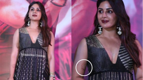 Samyuktha Menon: సంయుక్త చేతి పై ఈ గుర్తు చూసారా? వింత గుర్తుకు అర్థం ఏంటబ్బా!